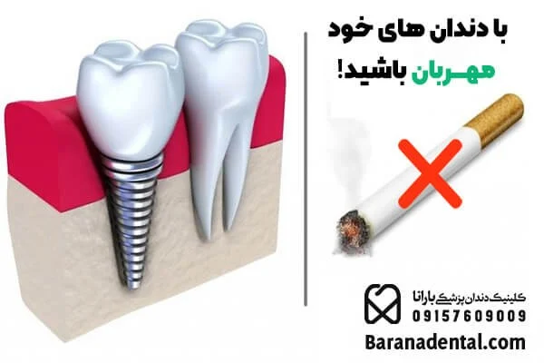 راه کارهای کاهش درد بعد از ایمپلنت