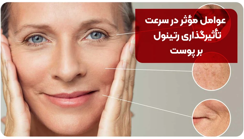 پوست عوامل مؤثر در سرعت تأثیرگذاری رتینول بر پوست